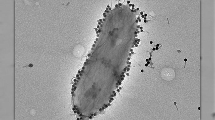 Imagem de microscópio de vírus bacteriófagos sobre bactéria