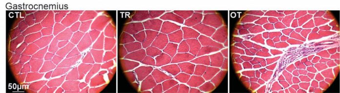 Pesquisadores brasileiros resolvem mistério de sintomas provocados por excesso de exercícios físicos
