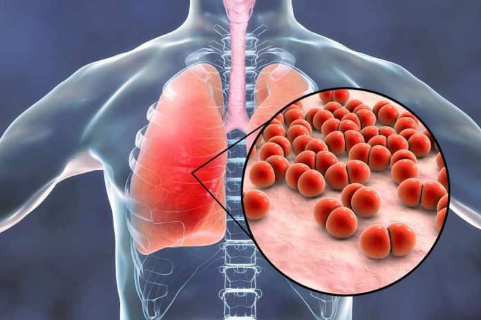 pneumonia