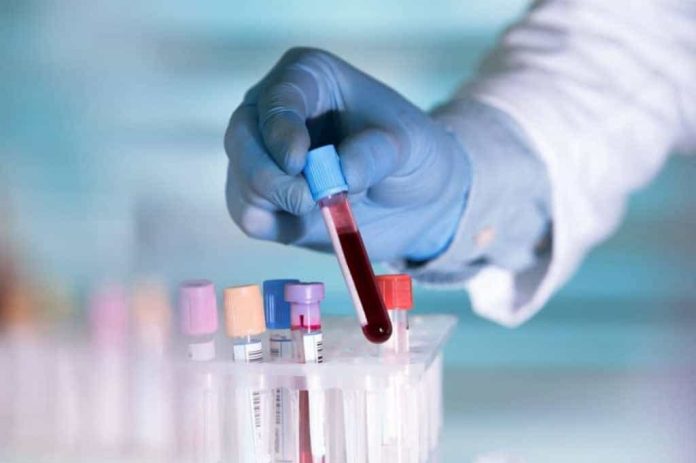 Vidro com sangue segurado por alguém com luvas azuis e jaleco branco