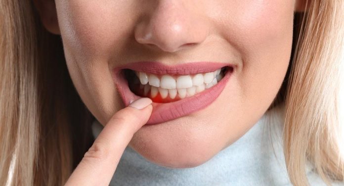 Mau hálito: um problema comum, mas que você pode prevenir