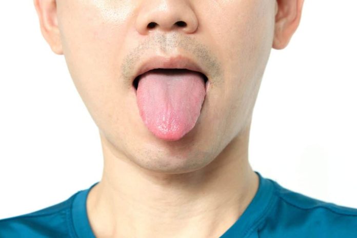 Como e por que a língua indica problemas de saúde?