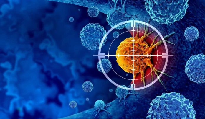 Sensor brasileiro promete detectar câncer de pâncreas em minutos